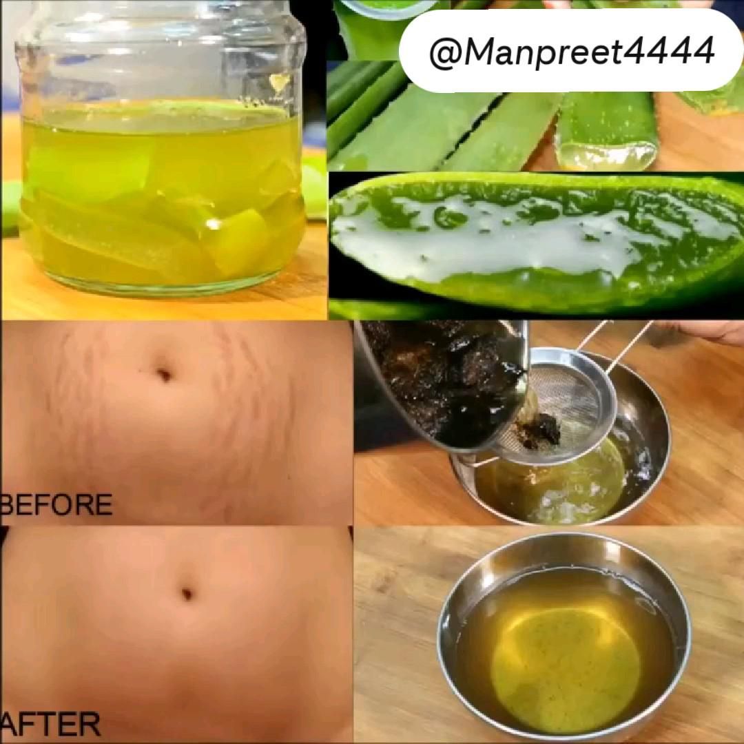 5 natural remedies for dry skin relief – Artofit
